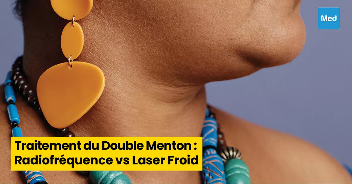 Traitement du Double Menton : Radiofréquence vs Laser Froid